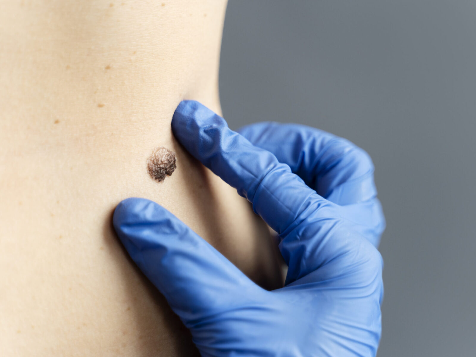 close-up-hand-with-glove-measuring-mole